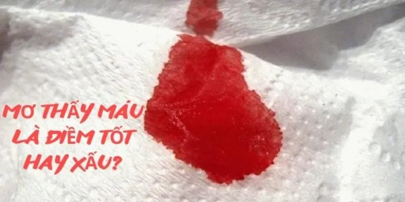 Ý Nghĩa Của Giấc Mơ Thấy Máu