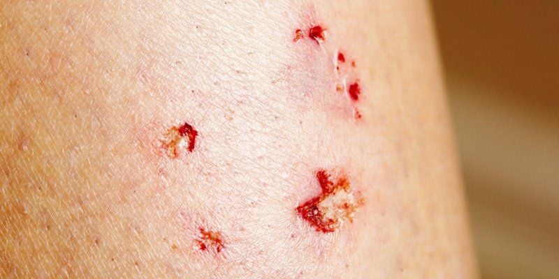 Mơ Thấy Máu Là Điềm Gì Những Điềm Báo Từ Giấc Mơ Thấy Máu